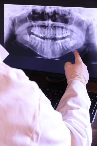 Best Emergency Root Canal Treatment in Malvern, AR