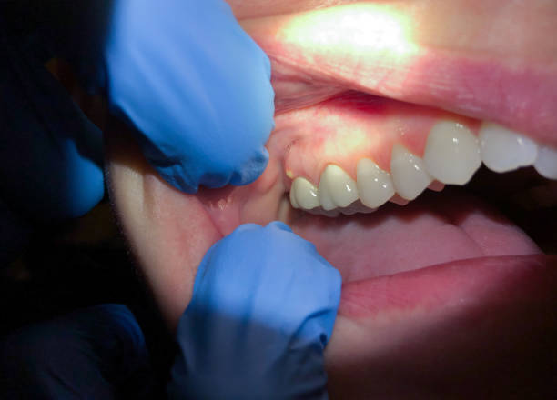 Best Pediatric Emergency Dentist in Malvern, AR