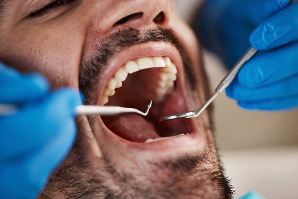 Best Emergency Treatment for Toothache in Malvern, AR